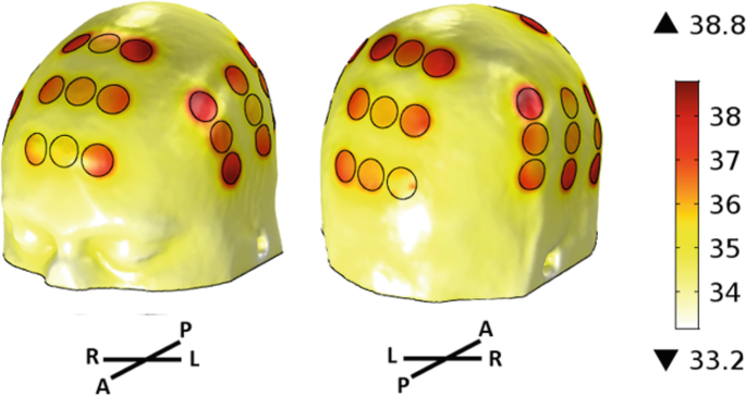 An image depicts temperature layouts in two skull models. The highest achieved temperature is 38 degree Celsius and the lowest is 34 degree Celsius.