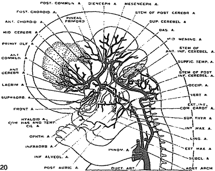 A diagram of the cross-sectional view of an embryo in stage 23. The embryo has a shifted cranial-caudal alignment. The cerebellar arteries are properly developed along with the choroid plexus.