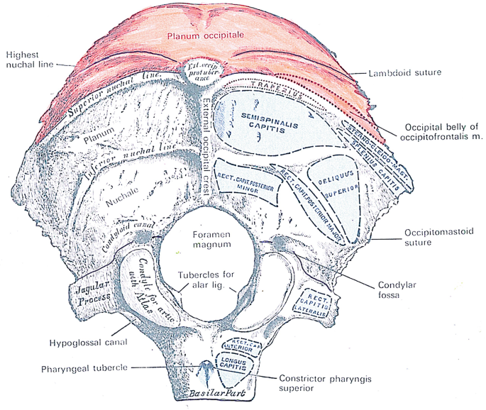 Topographic sketch. Coronal view of bilateral DRT (orange). Patient