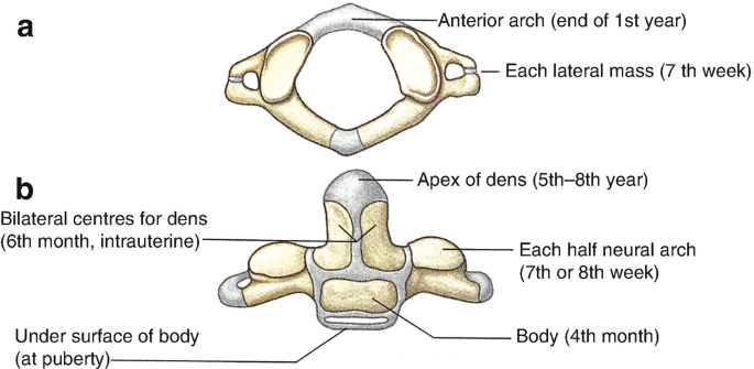 Topographic sketch. Coronal view of bilateral DRT (orange). Patient