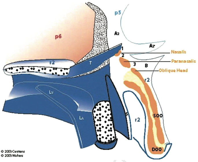 A diagram depicts the lateral wall dissection. The parts of the nasalis, paranasalis, oblique head, vestibular lining, turbinate flap, sliding sulcus flap, mucoperiosteal flap, D O O, and S O O are labeled.