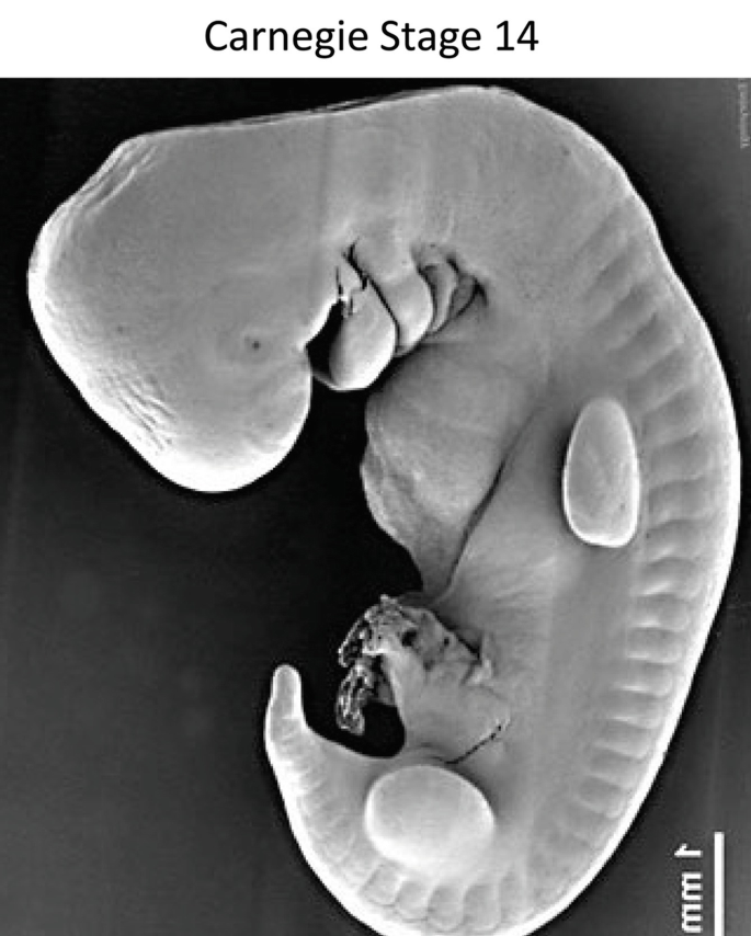 An image of Carnegie stage 14 has a curved embryo in an inverted C shape and body parts in a bud stage.