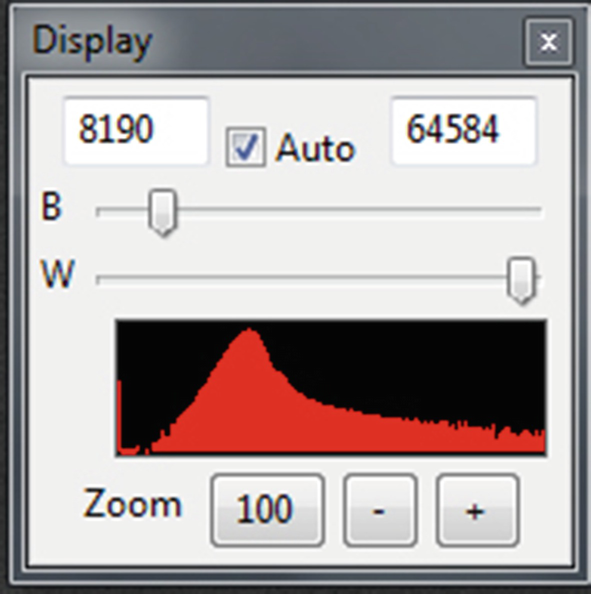 A screenshot of Nebulosity, indicates the display tab. The histogram illustrates the data stretched to fit the full width and follows an increasing trend in the beginning, and decreasing trend throughout.