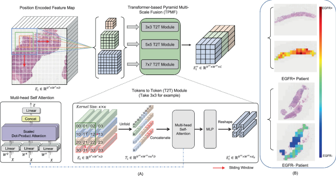 SETMIL: Spatial Encoding Transformer-Based Multiple Instance Learning for  Pathological Image Analysis