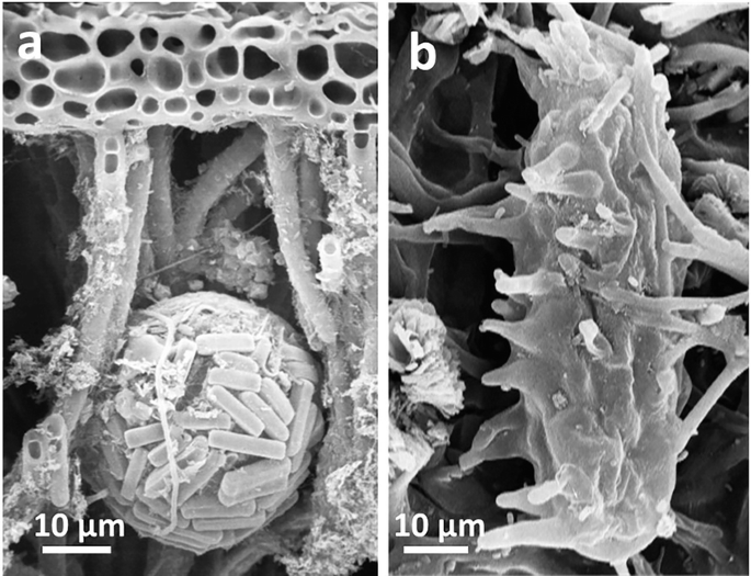 Two diagrams depict the microfauna of lichen thalli. a. Testate amoeba with agglutinate shell,. b. Tardigrade on the surface of a campylidum. The label measures for a and b is 10 micrometer.