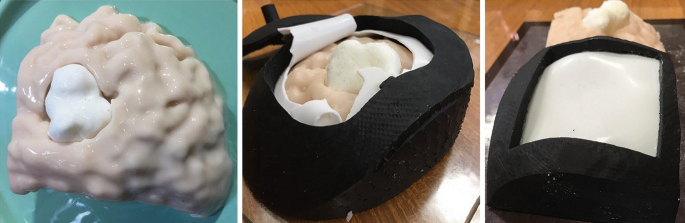 3 photographs. a. A 3-D model of a brain phantom. b. The brain is placed into the fabricated 3-D printed head phantom. c. The placed brain is covered.