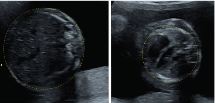 Two ultrasounds of the abdomen and thorax appear in darker shades.