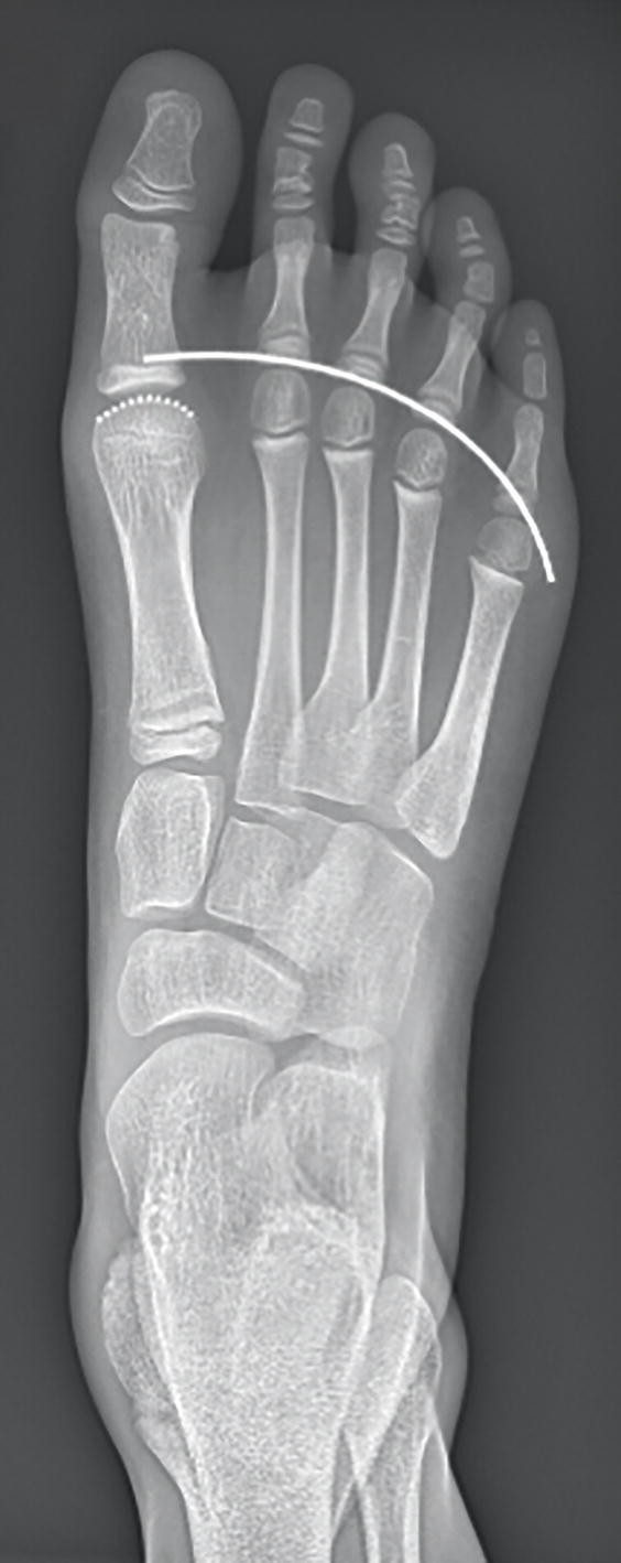 Ankle and Foot | Springer Nature Link