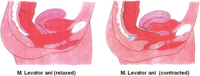 Two illustrations. The relaxed vagina, on the left, is straight and accessible while the contracted vagina on the right is curved and less accessible.