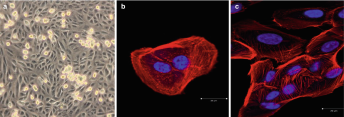 The three microscopic photographs represent the retinal pigment epithelium cells, where a displays phase contrast microscopy, and b depicts confocal laser scan microscopy.