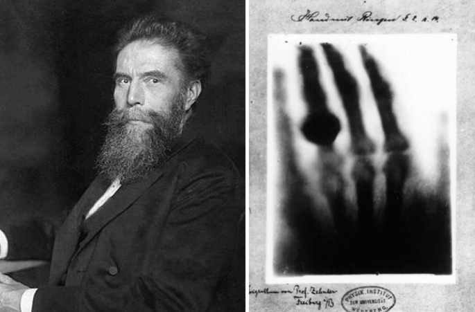 A photograph on the left of Wilhelm Rontgen. An X ray of a hand with a large ring.