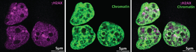 Three micrographs with two fluorescent dyes depict the presence of gamma H 2 A X, chromatin, and gamma H 2 A X with chromatin, respectively, at 5-micrometer scales.