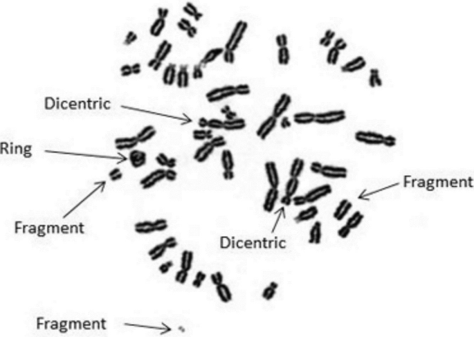 A set of chromosomes at the metaphase stage and exposed to gamma radiation depicts abnormal dicentric, fragmented, and ring chromosomes.