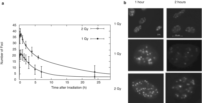 A line graph with error plots depicts the number of foci versus time after irradiation for 1 and 2 gray units. Both lines exhibit a downward trend. A set of 6 microscopic images compares the foci at one hour and two hours of 1, 1, and 3 G y. 2 G y depicts a large cluster of foci.