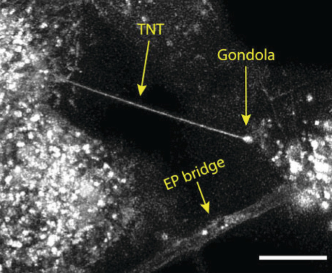 A micrograph highlights a thin intercellular membrane connected by a T N T with a gondola at its end and a thick epithelial bridge.