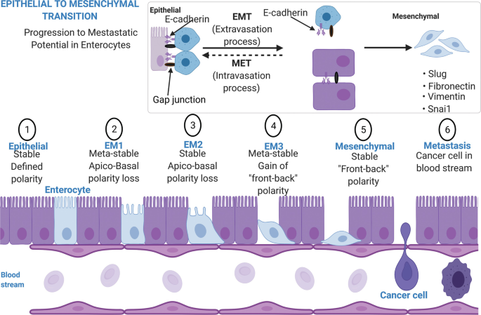 A diagram of the epithelial to mesenchymal transition. Some of the steps are Epithelial, stable defined polarity, E M 1, E M 2, E M 3, meta-stable, Apico-Basal polarity loss, gain of front-back polarity, mesenchymal, stable, front-back polarity, and metastasis, cancer cell in blood stream.
