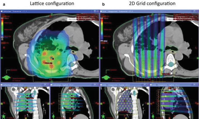Two sets of three magnetic resonance images in lattice and 2 D grid configurations.