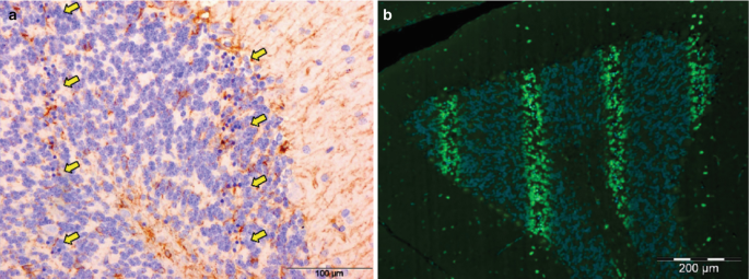 A hematoxylin and eosin stain image of the cerebellum of a rat displays the leftward arrows denote the track of the microbeams. An immunostaining image of the different section of the cerebellum of a rat exhibits the four vertical green staining.