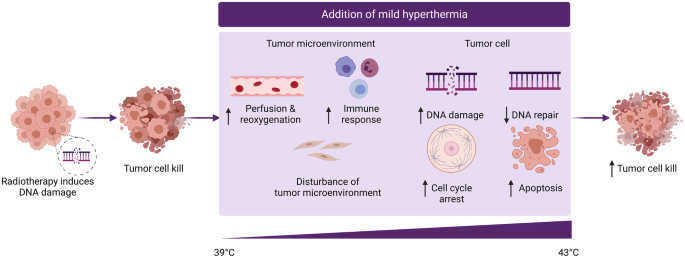 A diagram illustrates that radiotherapy induces D N A damage, but with the addition of mild hyperthermia, there is perfusion and reoxygenation, and immune response among others, and inhibition of D N A repair temporarily which causes D N A damage, cell cycle arrest, and apoptosis in the tumor cell.