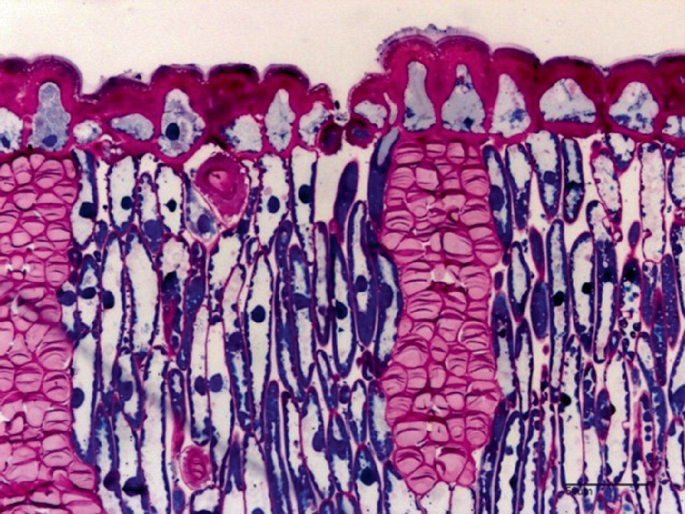 A photo of a micrograph in which cells and hypodermal pink fibers are portrayed.
