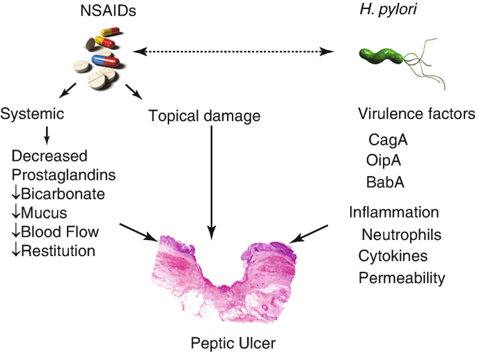 A pictorial flow chart represents the cause of peptic ulcer due to N S A I Ds and Helicobacter pylori. Several systemic and topical damage caused by N S A I Ds and the virulence factors exhibited by Helicobacter pylori lead to peptic ulcer.