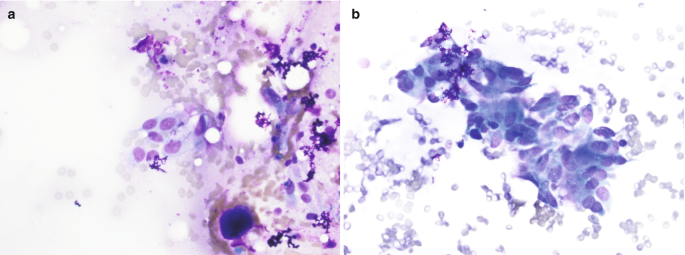 Two microscopic images of the respiratory epithelial cells labeled A and B. Image A includes white spaces, purple dots, and blue patches. Image B depicts an irregular contour surrounded by pale granules.