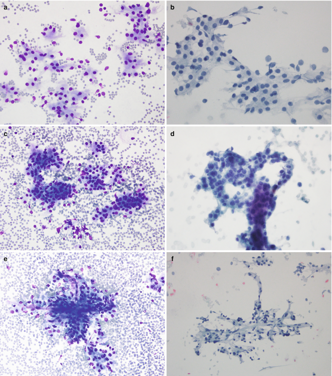 Eight microscopic images of the normal parathyroid cells labeled A to H . Images A, C, and E depict clusters of blue and purple dots on a grey surface surrounded by many dots. B and D highlight contours with dark blue dots. F and G highlight scattered dots.