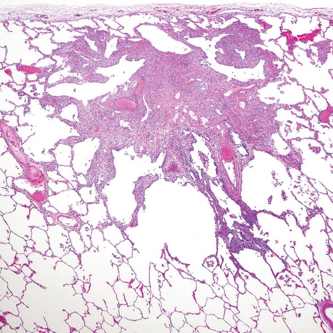 A micrograph resembles a star-like shape. One of the branches from the star has darkly staining cells.