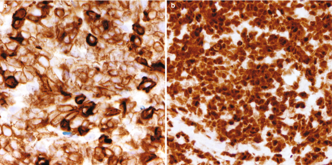 Two micrographs highlight the heavy extracellular and intracellular uptake of C D 3 and T A L L or T L B L, respectively.