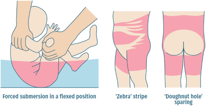 Surgitek SRL: Para que las heridas no ganen la batalla