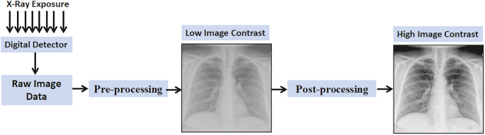 Radiation Protection in Diagnostic X-Ray Imaging