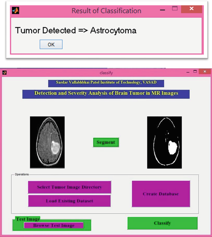 The test database of MR brain images and corresponding results for the