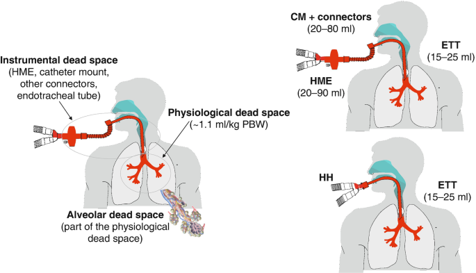 A schematic representation of dead space portions classified into instrumental dead space, alveolar dead space, physiological dead space, C M + connectors, H M E, E T T, and H H.