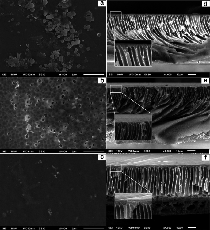 A set of 6 S E M images of membrane surface morphology, a through f. Images a and b have solid circular particles floating in the liquid. Image c has tiny bits floating in the liquid. Images d and e have textured layers and f has the label at the section with which the textured layer is attached. The label is, P V A layer.