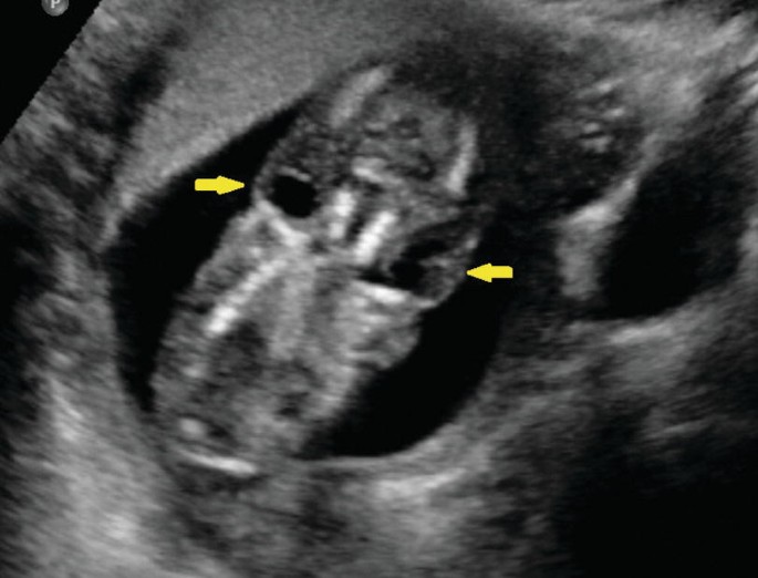 Blue Baby Boy Sonogram Ultrasound Pregnancy Book 3 Ring Binder