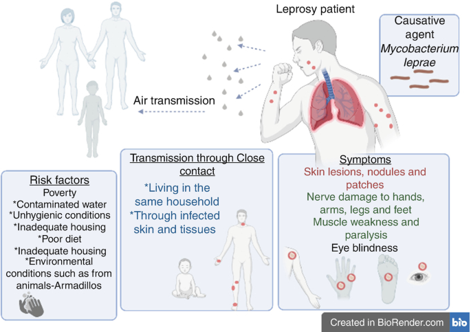 An illustration demonstrates the transmission of the causative agent through the air. An illustration of a coughing leprosy patient with superimposed lung structures and spots of causative agent Mycobacterium leprae leads to air transmission of the causative agent through saliva droplets to other humans. 3 block charts below the illustration represent a list of elements for risk factors, transmission through close contact, and symptoms.