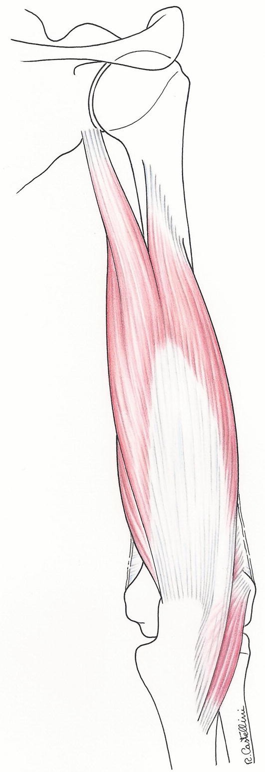 Disorders-of-the-Biceps-and-the-Triceps – OrthoPaedia