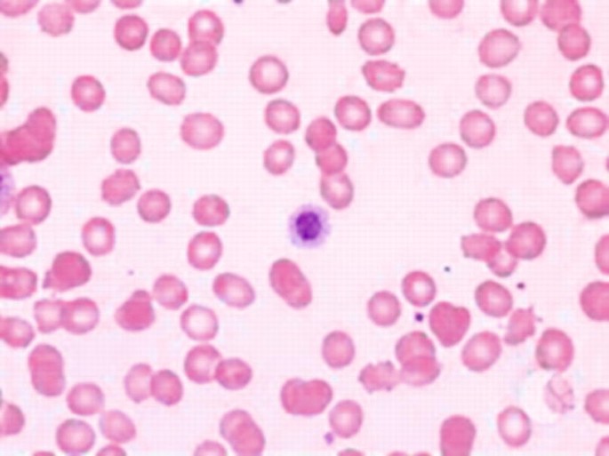 kb glutathione price mercury drugstore 2018 Monocyte to macrophage differentiation and changes in cellular redox  homeostasis promote cell type-specific HIV latency reactivation
