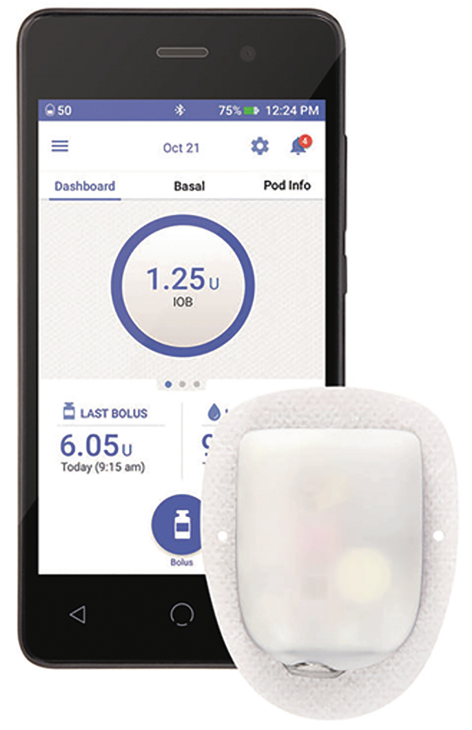 A mobile screen has settings and bell icons on the top right. It consists of 3 menus on the top. The value of an insulin level under the Dashboard tab is reflected as 1.25 U, I O B. Below is the last Bolus with a value of 6.05 U.