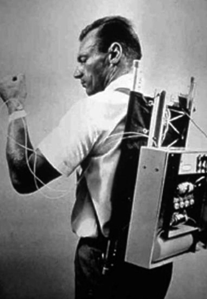 A photograph of Doctor Arnold Kadish, who carries an insulin pump. The tubes from the pump are connected to his hand.