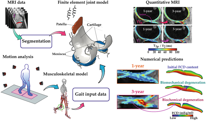 A diagram and M R Is for multiscale in vivo modeling of cartilage injuries. The diagram has a finite model joint element created from M R I data through segmentation, and motion analysis through Gait input data. The joint model has three parts, the patella, cartilage, and meniscus. A set of quantitative M R differences between 1 and 3 years.