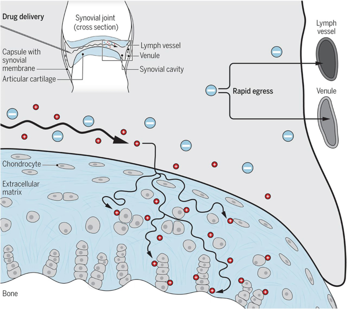 An illustration of drug delivery to chondrocytes. The drug is injected into the synovial cavity. The positive particles reach the chondrocytes, and the negative particles are ejected through the lymphatic system.