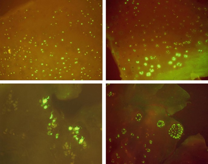Four photomicrographs of chondrocytes tagged with fluorescent G F P. The photos present clusters of fluorescent spots distributed throughout the cartilage.
