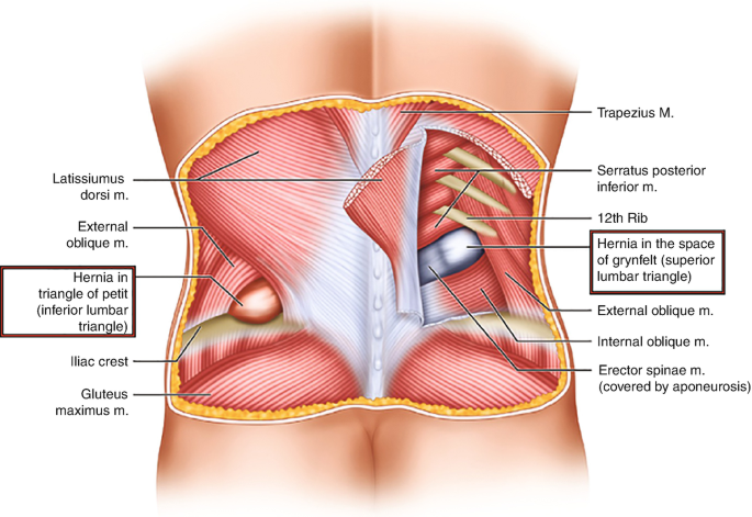 a) The superior lumbar triangle bordered by the 12th rib, internal