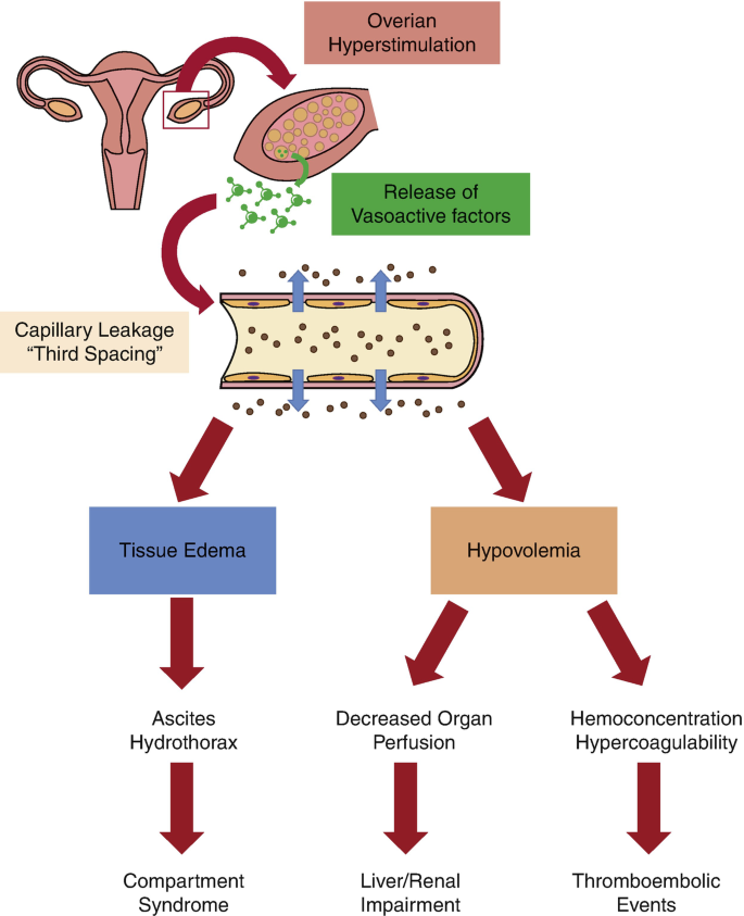 In vitro Study of Hemodynamic Treatment Improvement: Hunterian