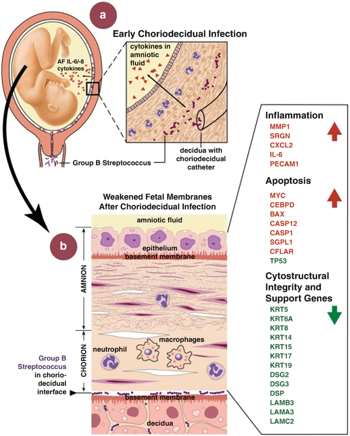 Cureus, Acute Urinary Retention in the First-trimester of Pregnancy: A  Case Report