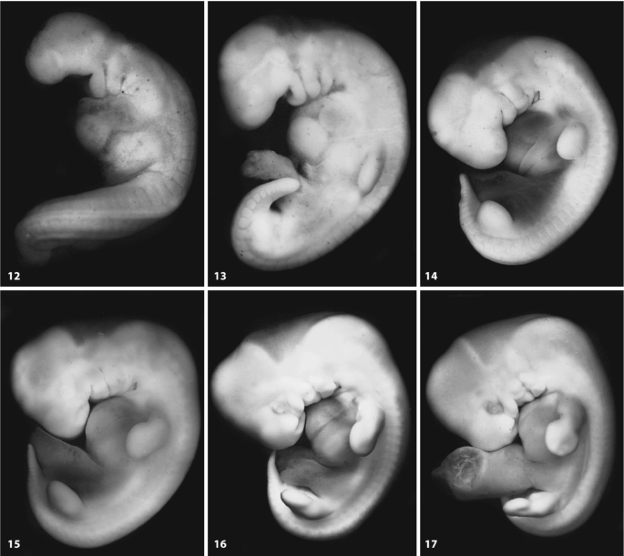 12 M R images of Carnegie stages 12 to 23 of human embryos. In stages 12 to 17, the shape of the embryos is irregular, while in stages 18 to 23, their appearance resembles that of a newborn.