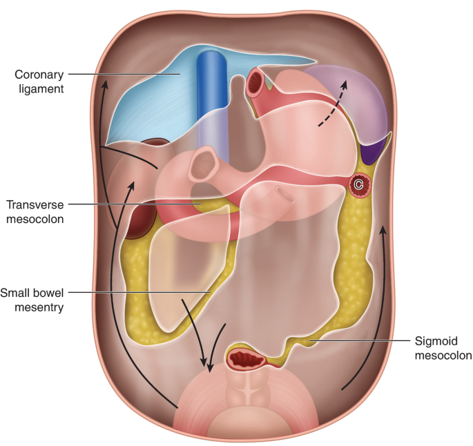 A diagrammatic representation of the abdomen. Coronary ligament, transverse mesocolon, small bowel mesentry, and sigmoid mesocolon are labeled.