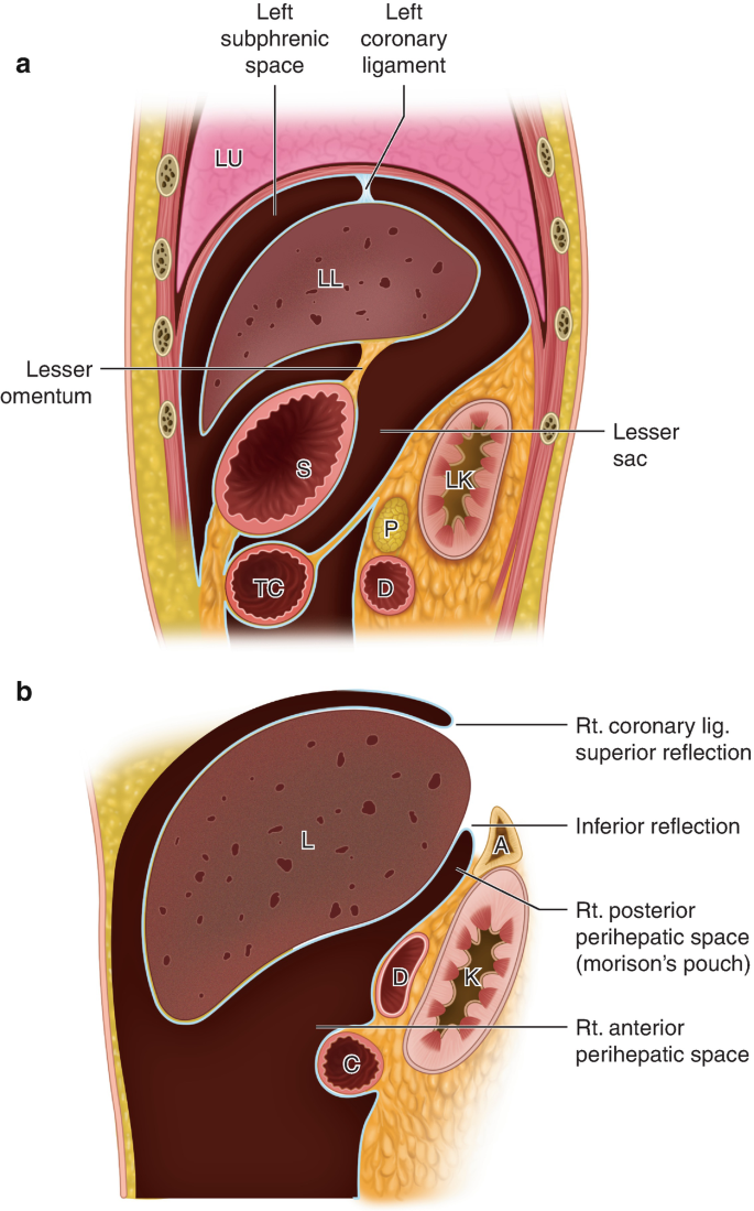 A diagrammatic representation of the abdomen and right side of the abdomen. A. left subphrenic space, left coronary ligament, lesser omentum, and lesser sac are labeled. B. right coronary ligament superior reflection, inferior reflection, right posterior perihepatic space, and right anterior perihepatic space are labeled.