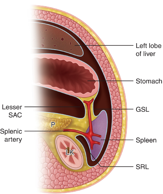 A diagrammatic representation of the upper left abdomen. The left lobe of the liver, stomach, G S L, spleen, S R L, lesser S A C, P, L K, and splenic artery is labeled.